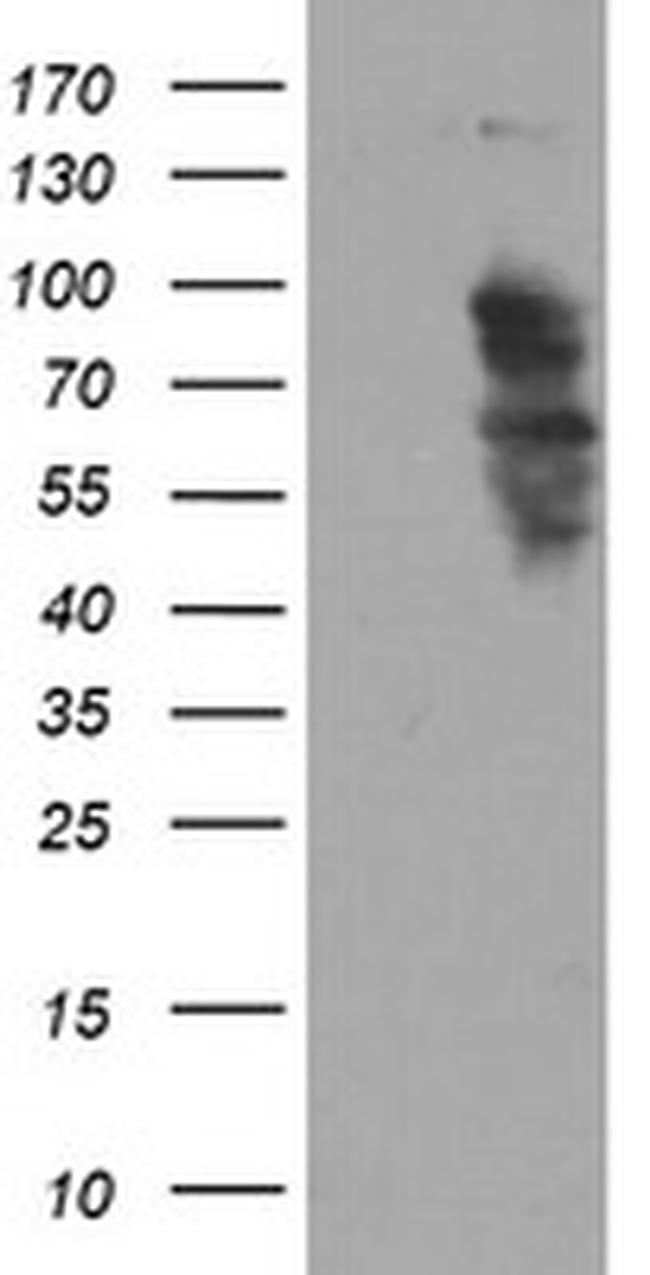 SOX5 Antibody in Western Blot (WB)