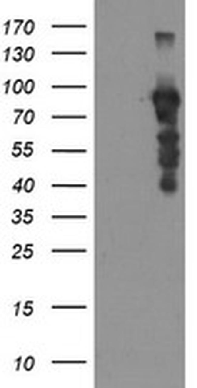 SOX5 Antibody in Western Blot (WB)