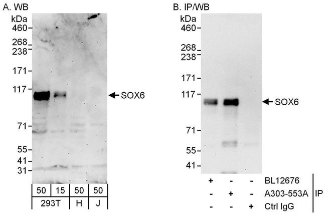 SOX6 Antibody in Western Blot (WB)