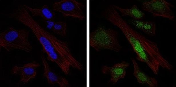 SOX9 Antibody in Immunocytochemistry (ICC/IF)