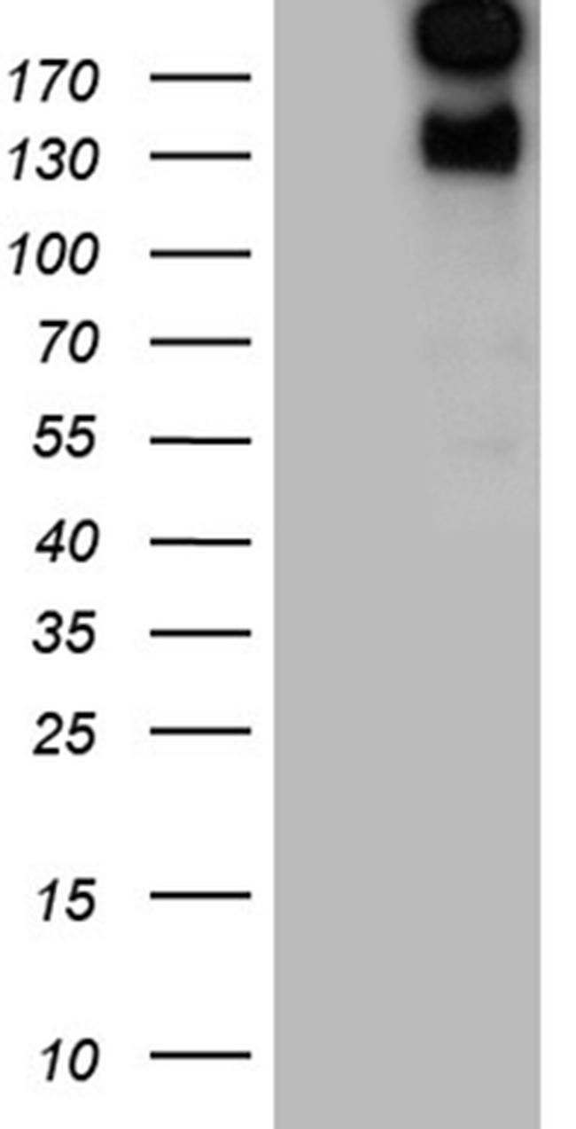 SPAG5 Antibody in Western Blot (WB)