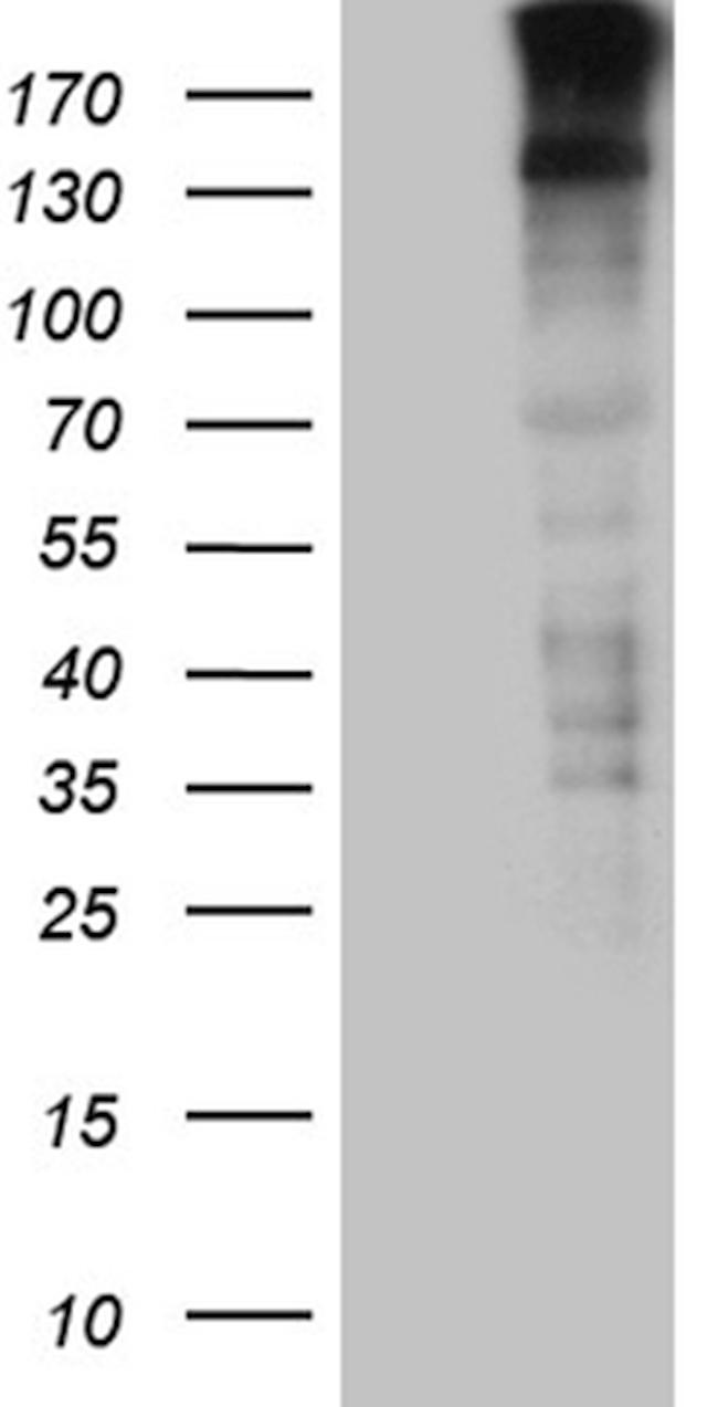 SPAG5 Antibody in Western Blot (WB)