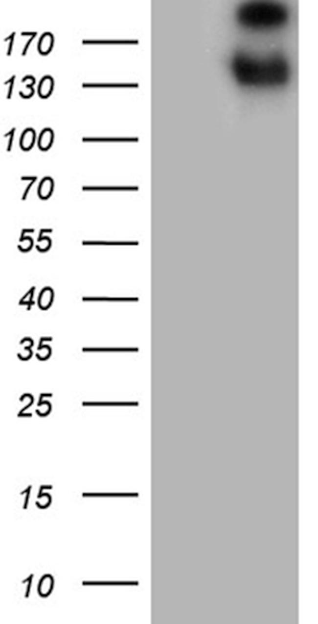 SPAG5 Antibody in Western Blot (WB)