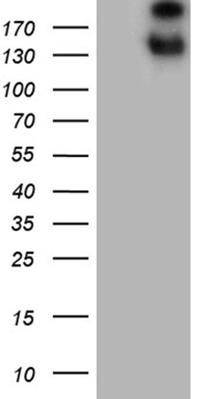 SPAG5 Antibody in Western Blot (WB)