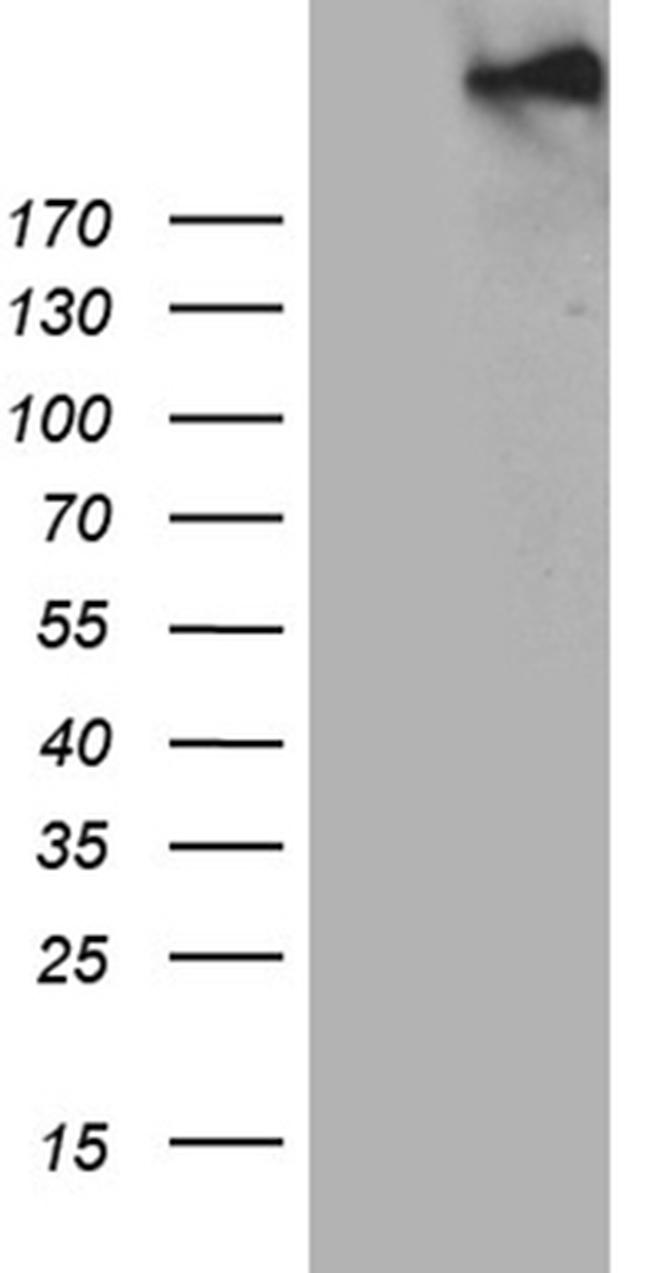 SPAG5 Antibody in Western Blot (WB)