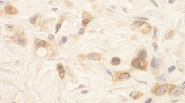 SPAK Antibody in Immunohistochemistry (IHC)