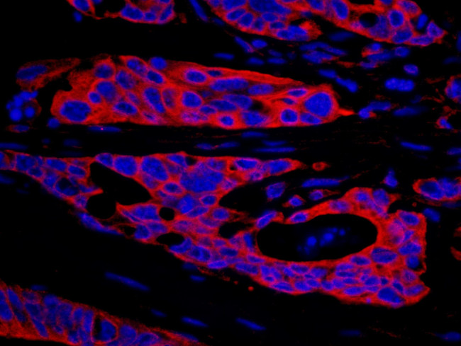 SPAK Antibody in Immunohistochemistry (IHC)