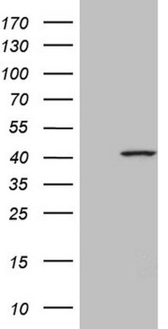 SPATA22 Antibody in Western Blot (WB)