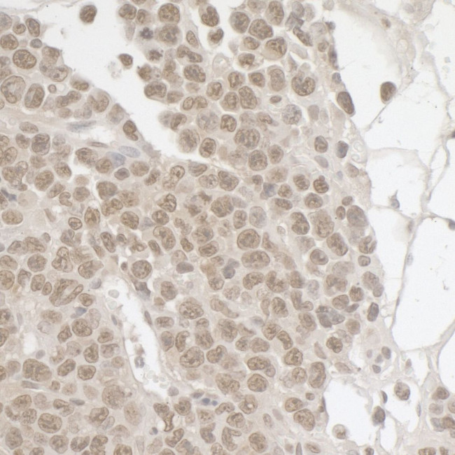 SPF45 Antibody in Immunohistochemistry (IHC)