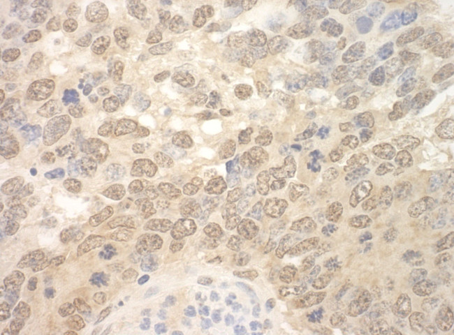 SPF45 Antibody in Immunohistochemistry (IHC)