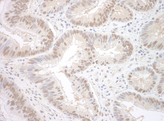 SPF45 Antibody in Immunohistochemistry (IHC)