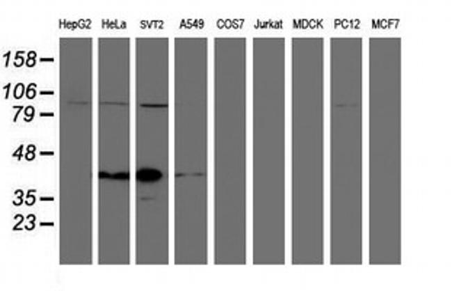 SPG7 Antibody in Western Blot (WB)