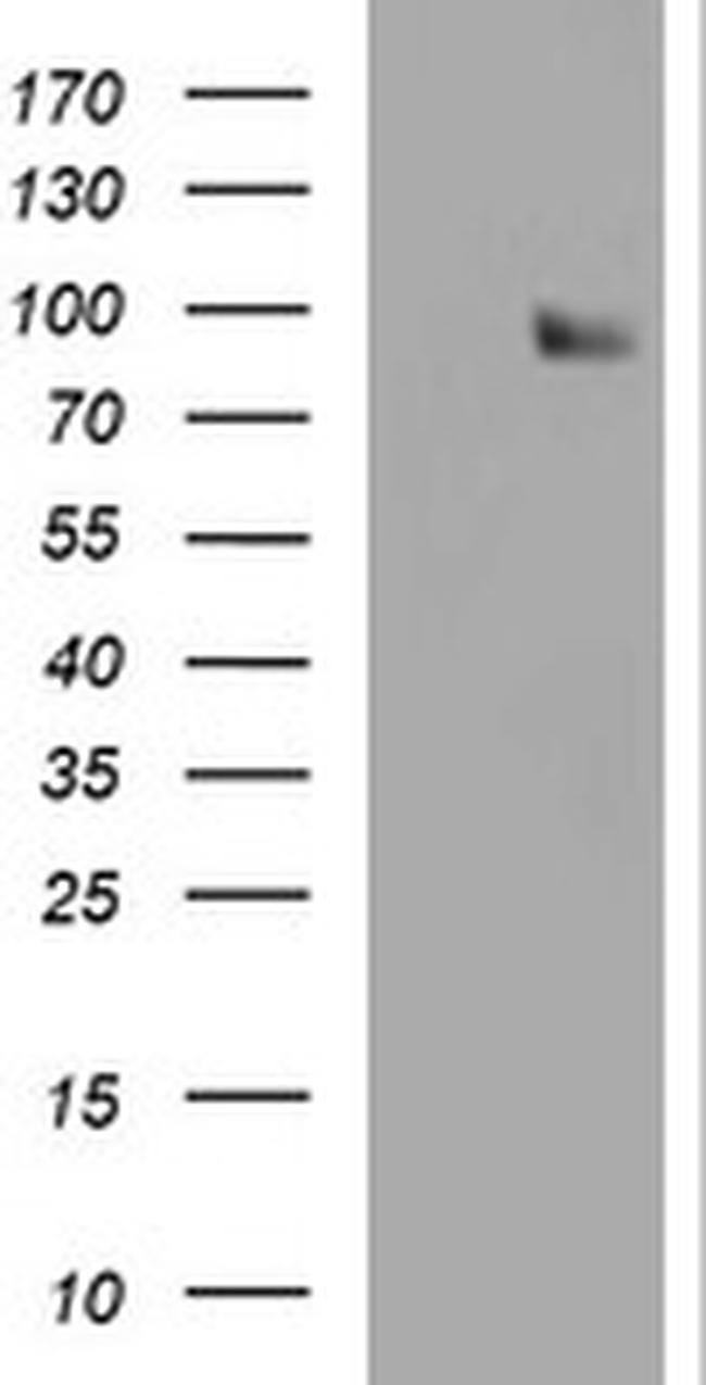 SPG7 Antibody in Western Blot (WB)