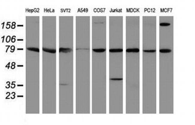 SPG7 Antibody in Western Blot (WB)