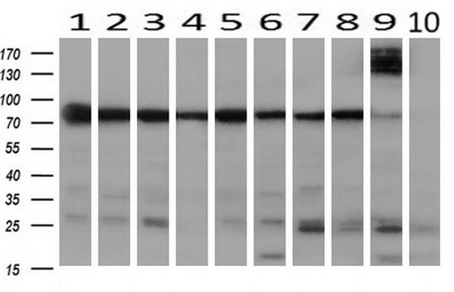 SPG7 Antibody in Western Blot (WB)