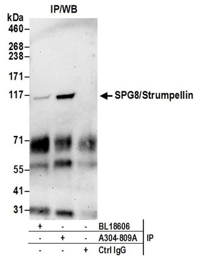 SPG8/Strumpellin Antibody in Western Blot (WB)