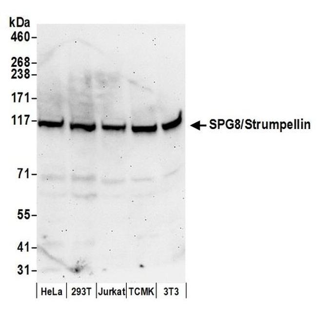 SPG8/Strumpellin Antibody in Western Blot (WB)