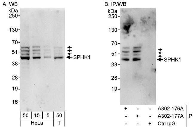 SPHK1 Antibody in Western Blot (WB)