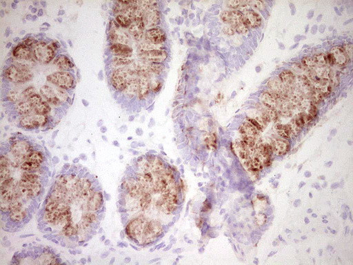 SPP1 Antibody in Immunohistochemistry (Paraffin) (IHC (P))