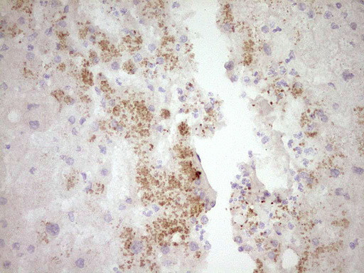 SPP1 Antibody in Immunohistochemistry (Paraffin) (IHC (P))