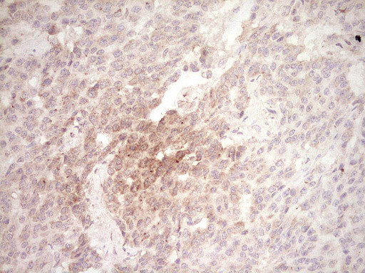 SPP1 Antibody in Immunohistochemistry (Paraffin) (IHC (P))