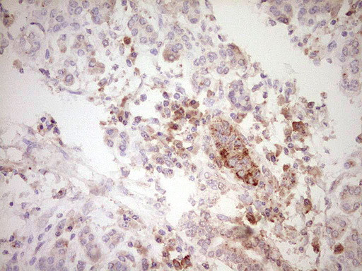 SPP1 Antibody in Immunohistochemistry (Paraffin) (IHC (P))