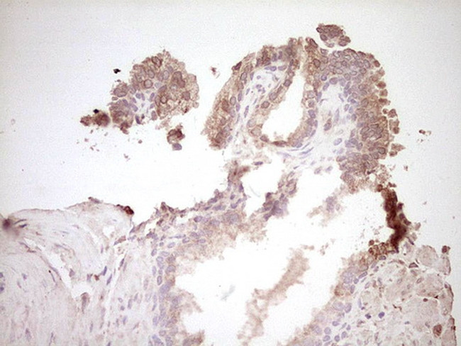 SPP1 Antibody in Immunohistochemistry (Paraffin) (IHC (P))