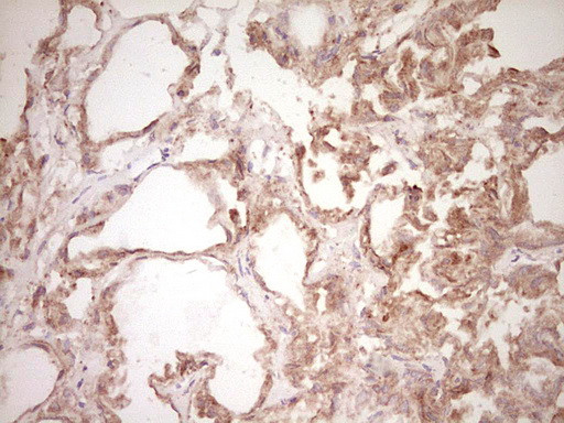 SPP1 Antibody in Immunohistochemistry (Paraffin) (IHC (P))