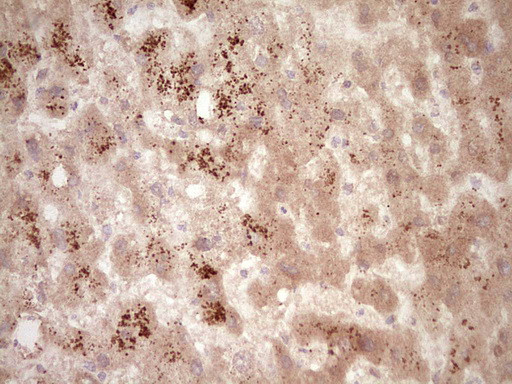 SPP1 Antibody in Immunohistochemistry (Paraffin) (IHC (P))