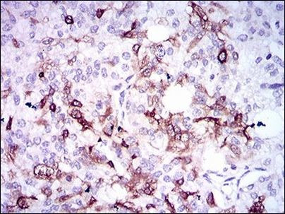 Osteopontin Antibody in Immunohistochemistry (Paraffin) (IHC (P))