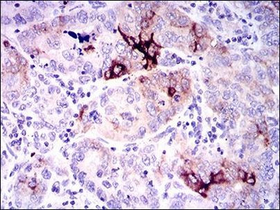 Osteopontin Antibody in Immunohistochemistry (Paraffin) (IHC (P))