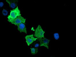 SPR Antibody in Immunocytochemistry (ICC/IF)