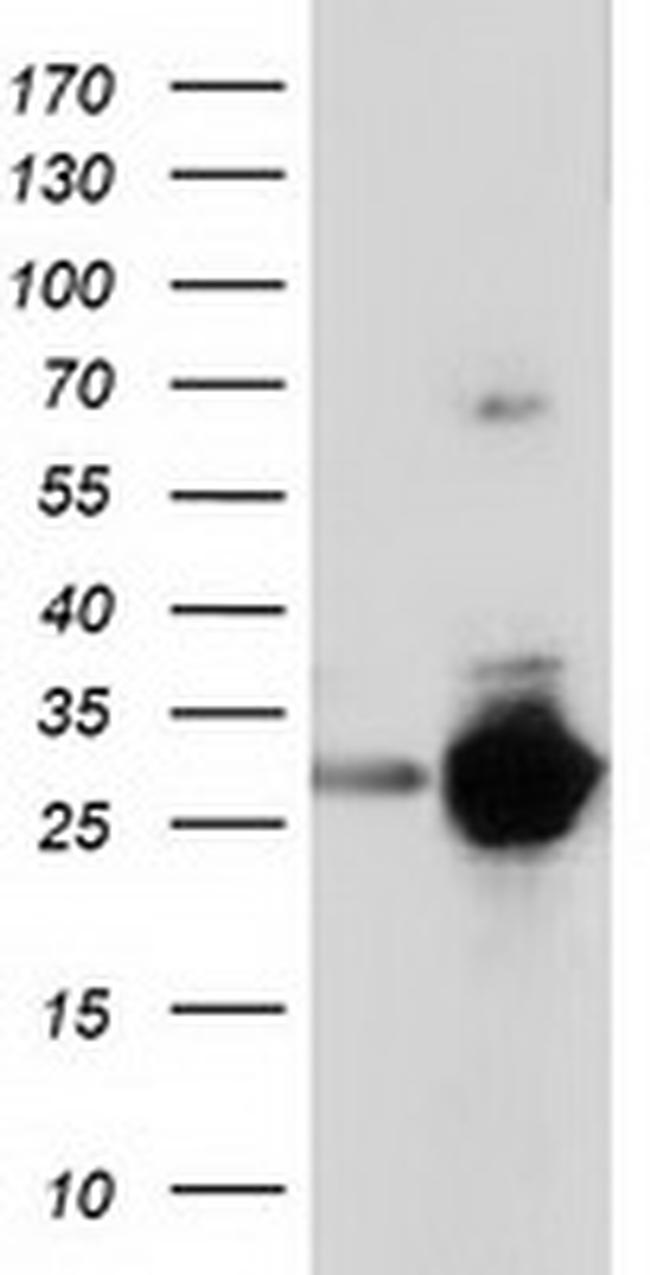 SPR Antibody in Western Blot (WB)