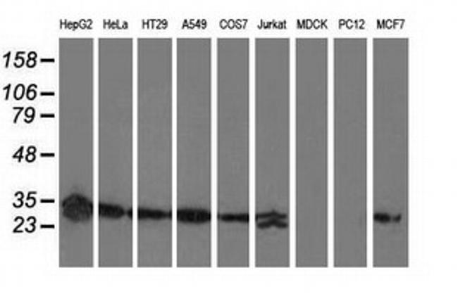 SPR Antibody in Western Blot (WB)