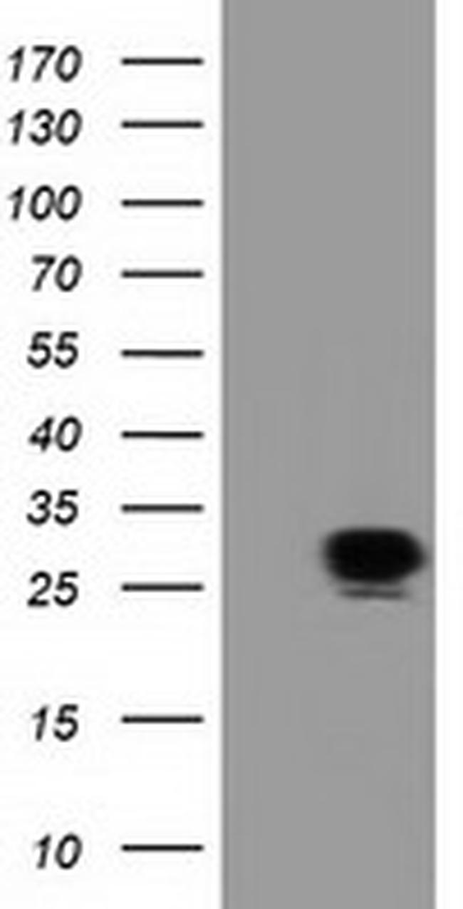 SPR Antibody in Western Blot (WB)