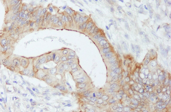 SPTBN1 Antibody in Immunohistochemistry (IHC)