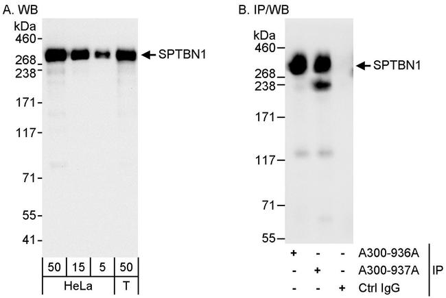 SPTBN1 Antibody in Western Blot (WB)