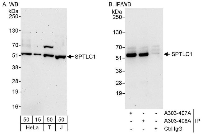 SPTLC1 Antibody in Western Blot (WB)