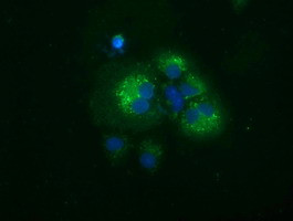 SQSTM1 Antibody in Immunocytochemistry (ICC/IF)