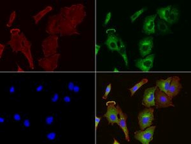 SQSTM1 Antibody in Immunocytochemistry (ICC/IF)