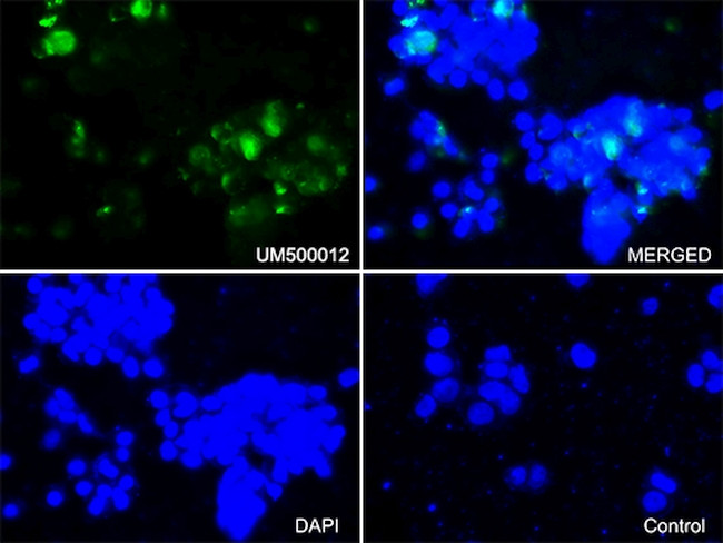 SQSTM1 Antibody in Immunocytochemistry (ICC/IF)