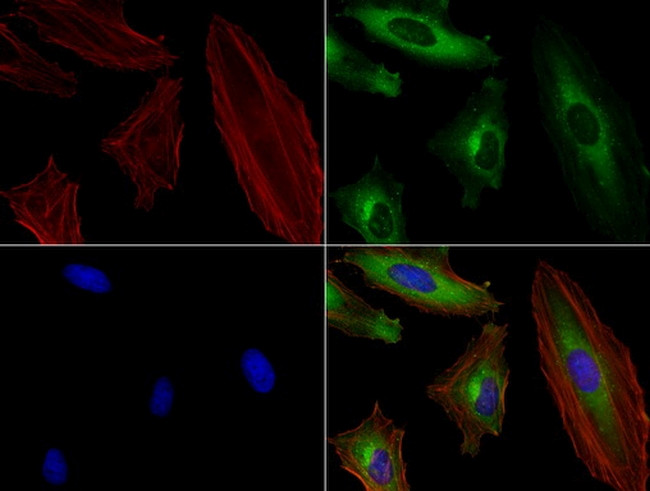 SQSTM1 Antibody in Immunocytochemistry (ICC/IF)