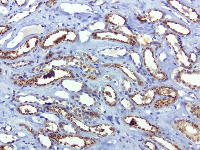 SQSTM1 Antibody in Immunohistochemistry (Paraffin) (IHC (P))