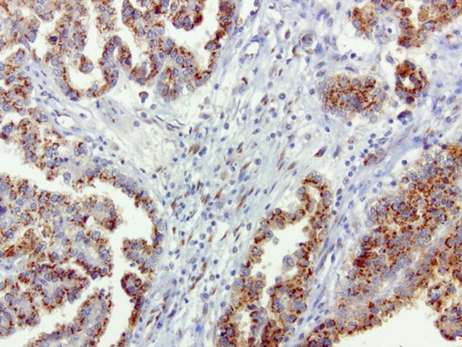 SQSTM1 Antibody in Immunohistochemistry (Paraffin) (IHC (P))