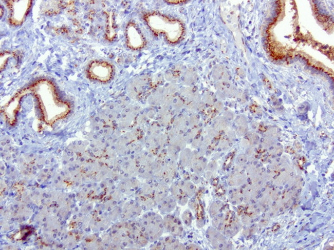 SQSTM1 Antibody in Immunohistochemistry (Paraffin) (IHC (P))