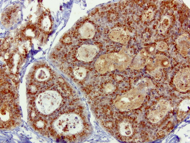 SQSTM1 Antibody in Immunohistochemistry (Paraffin) (IHC (P))