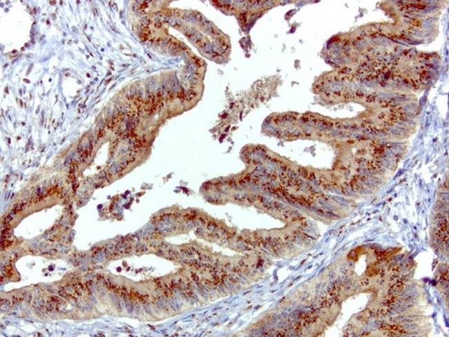 SQSTM1 Antibody in Immunohistochemistry (Paraffin) (IHC (P))