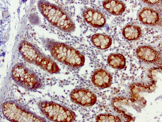 SQSTM1 Antibody in Immunohistochemistry (Paraffin) (IHC (P))