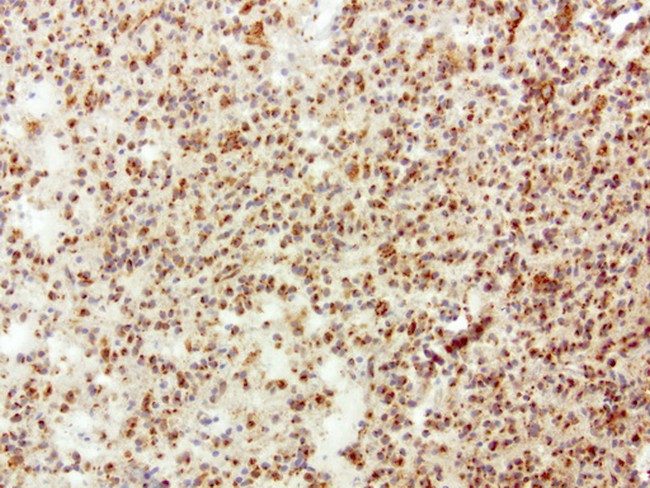 SQSTM1 Antibody in Immunohistochemistry (Paraffin) (IHC (P))