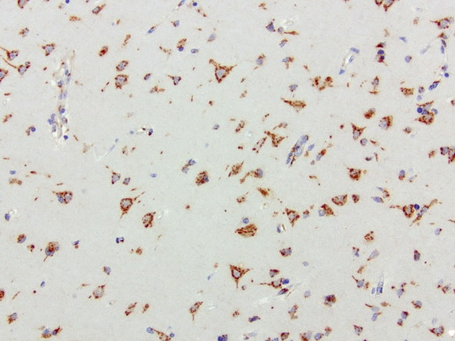 SQSTM1 Antibody in Immunohistochemistry (Paraffin) (IHC (P))